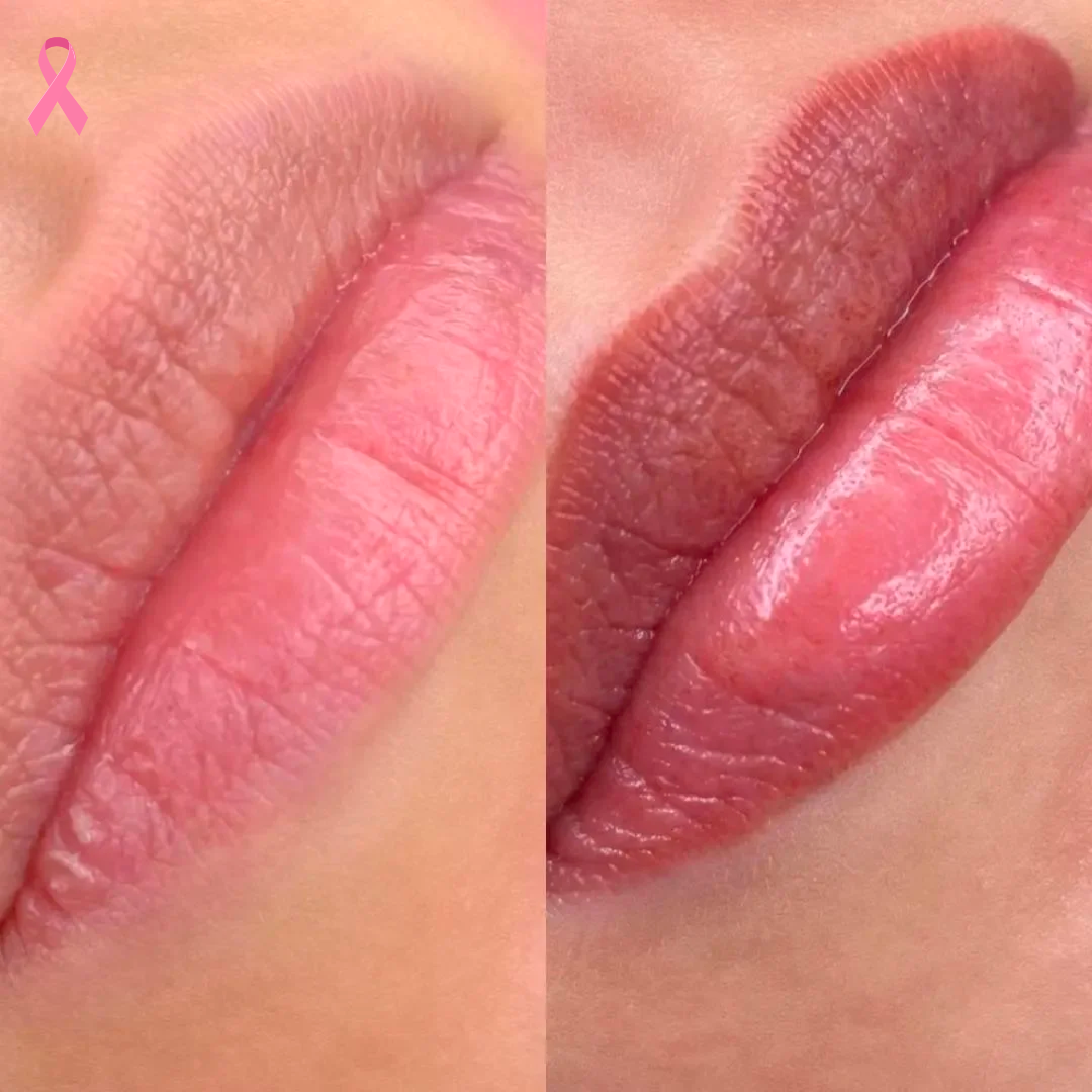 microblading - oncoestética