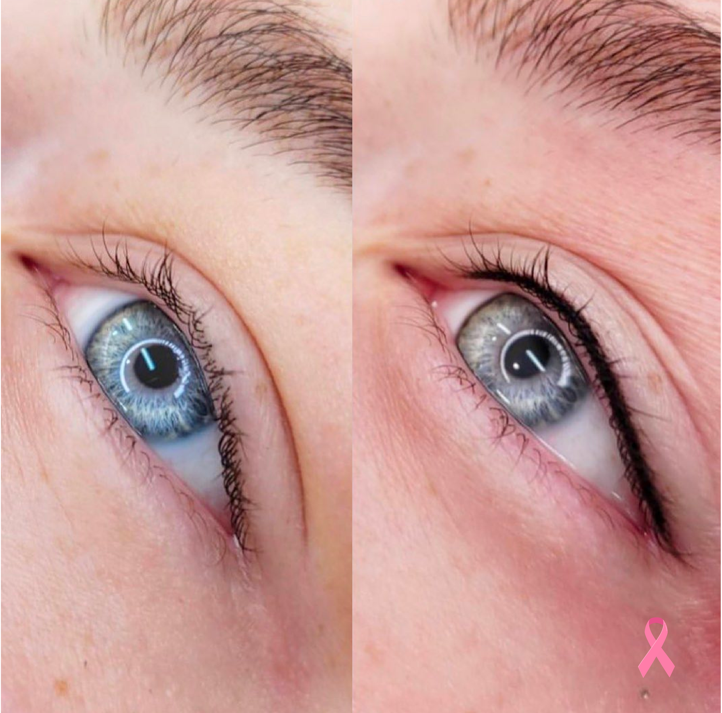 microblading en ojos - oncoestética