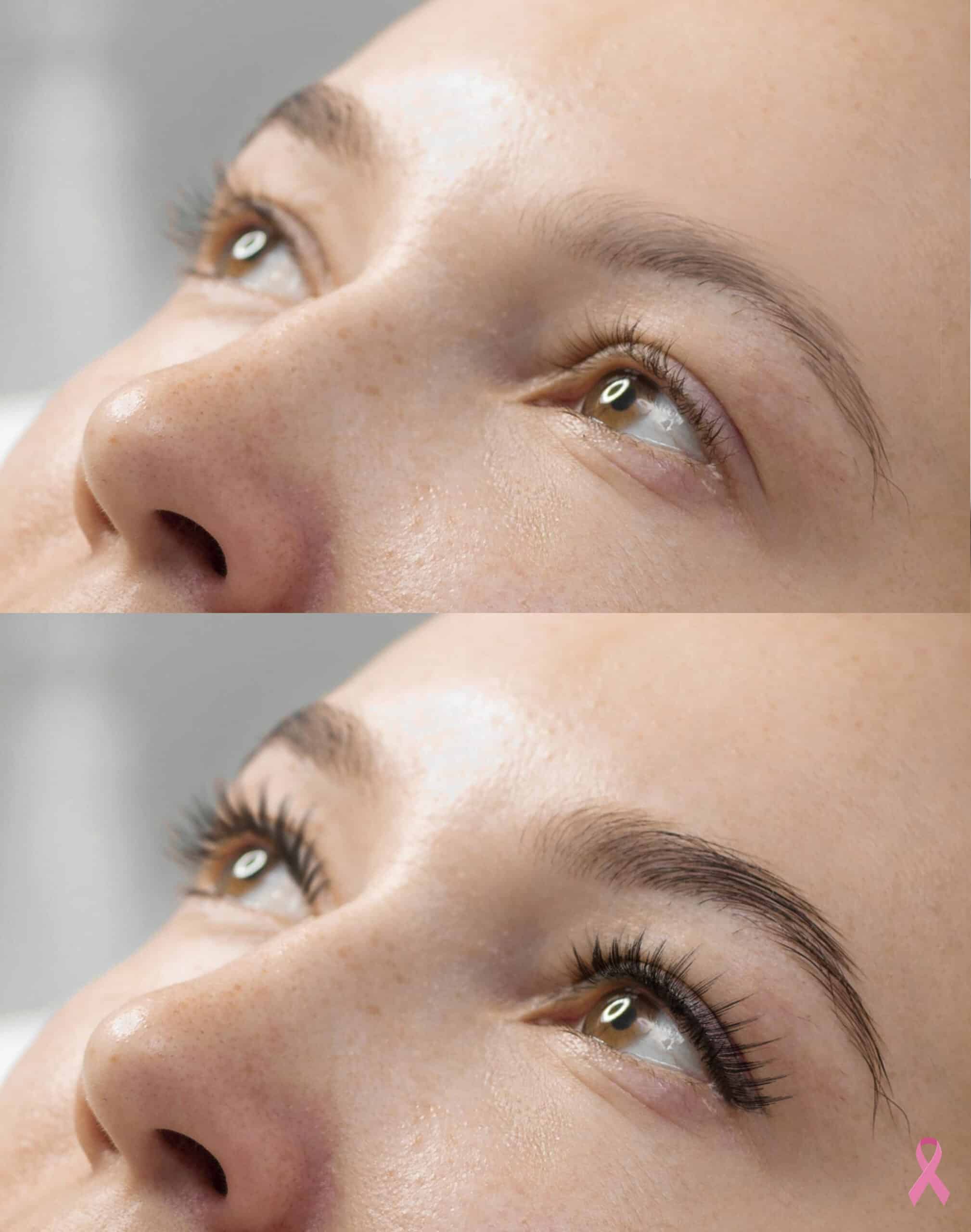 extensión de pestañas - oncoestética